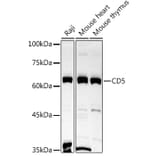 Western Blot - Anti-CD5 Antibody (A15411) - Antibodies.com