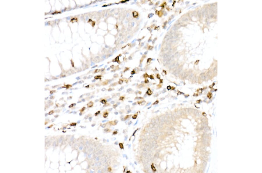 Immunohistochemistry - Anti-CD5 Antibody (A15411) - Antibodies.com