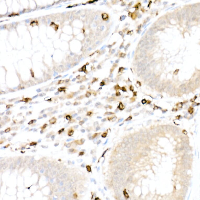 Immunohistochemistry - Anti-CD5 Antibody (A15411) - Antibodies.com