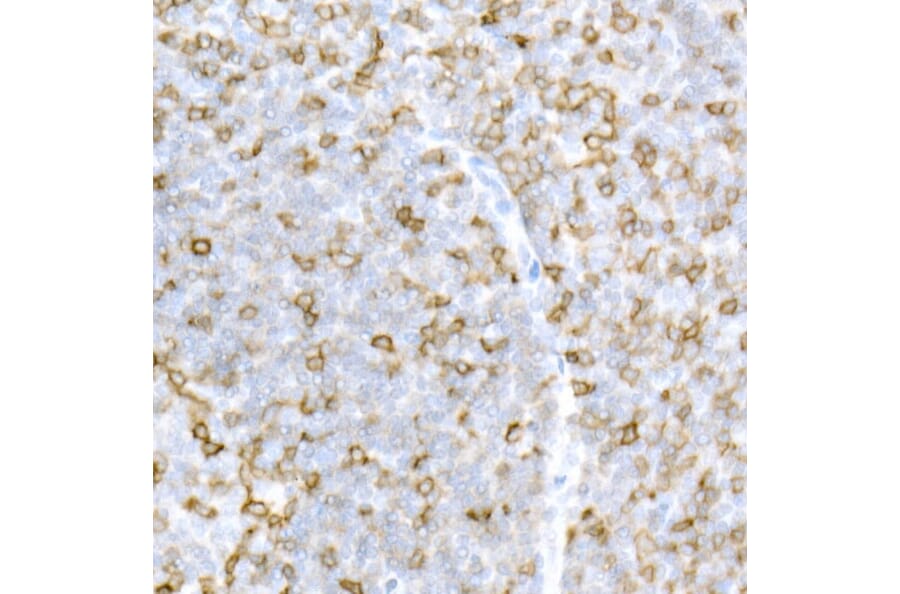 Immunohistochemistry - Anti-CD5 Antibody (A15411) - Antibodies.com