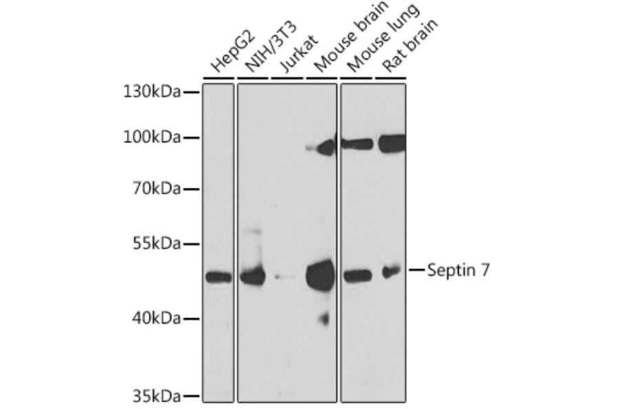 Western Blot - Anti-SEPT7 Antibody (A15412) - Antibodies.com