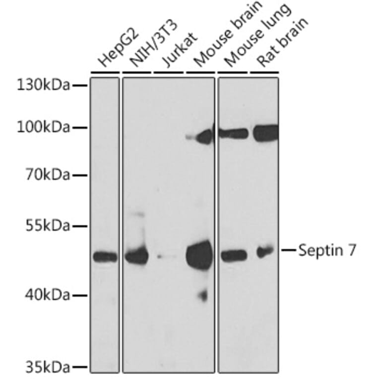 Western Blot - Anti-SEPT7 Antibody (A15412) - Antibodies.com
