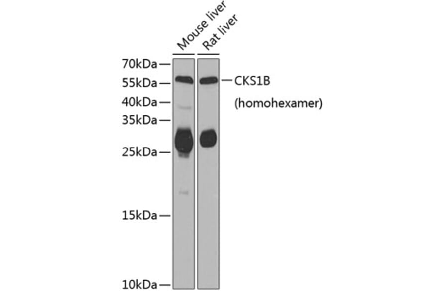 Western Blot - Anti-CKS1B Antibody (A6885) - Antibodies.com