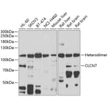 Western Blot - Anti-CLC7 Antibody (A15414) - Antibodies.com