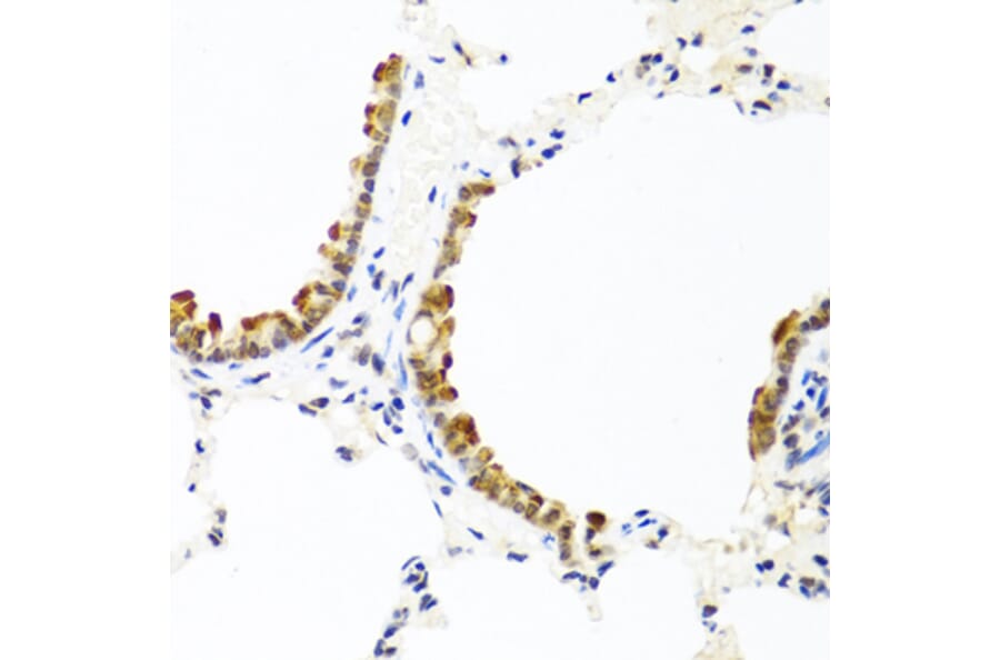 Immunohistochemistry - Anti-COL10A1 Antibody (A6889) - Antibodies.com