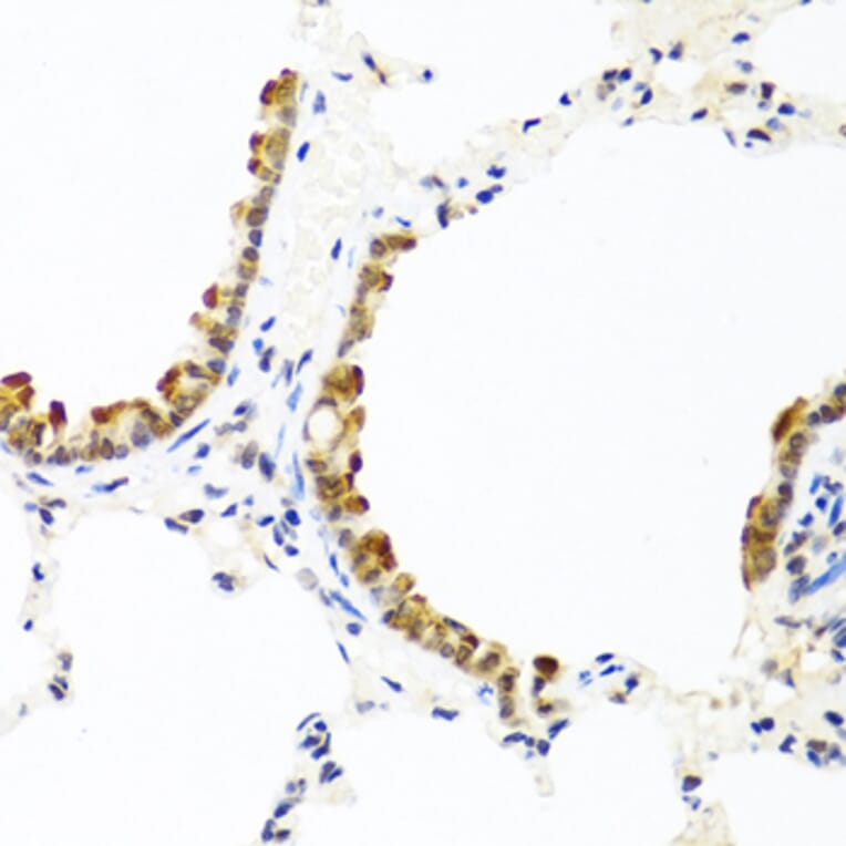 Immunohistochemistry - Anti-COL10A1 Antibody (A6889) - Antibodies.com