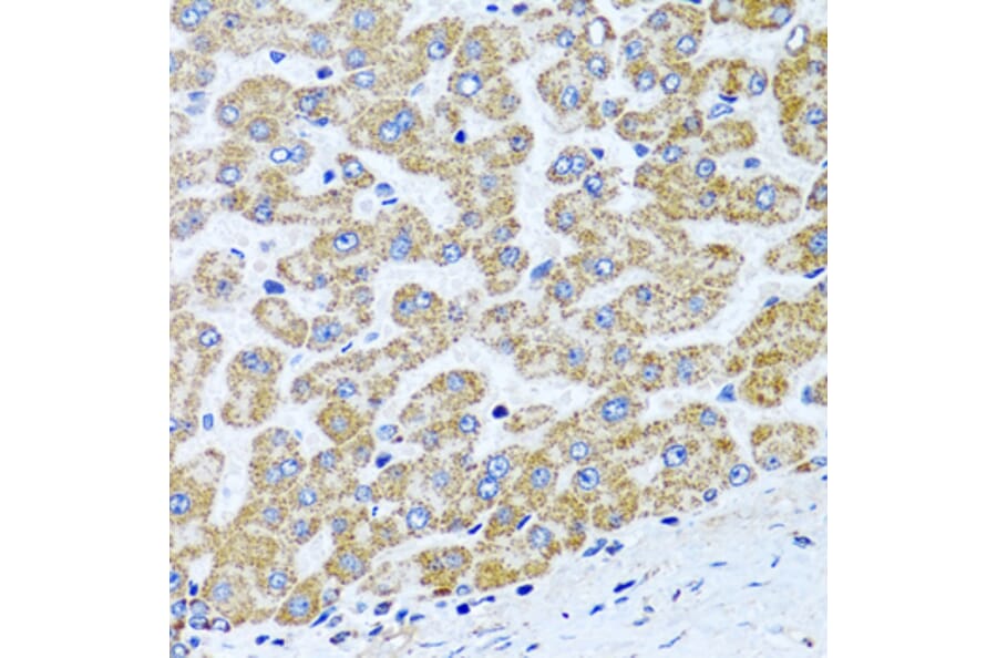 Immunohistochemistry - Anti-COL10A1 Antibody (A6889) - Antibodies.com
