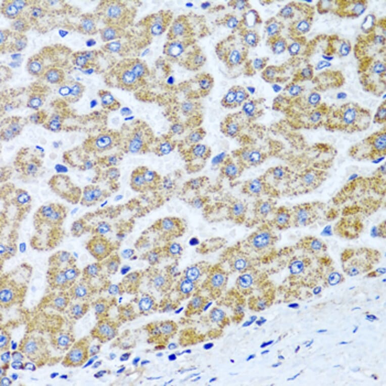 Immunohistochemistry - Anti-COL10A1 Antibody (A6889) - Antibodies.com