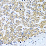 Immunohistochemistry - Anti-COL10A1 Antibody (A6889) - Antibodies.com