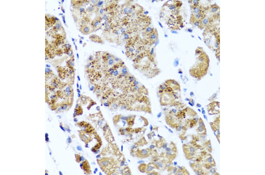 Immunohistochemistry - Anti-COL10A1 Antibody (A6889) - Antibodies.com