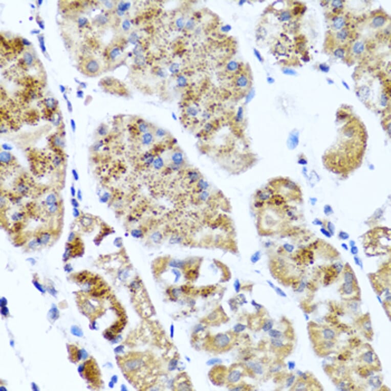 Immunohistochemistry - Anti-COL10A1 Antibody (A6889) - Antibodies.com