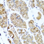 Immunohistochemistry - Anti-COL10A1 Antibody (A6889) - Antibodies.com