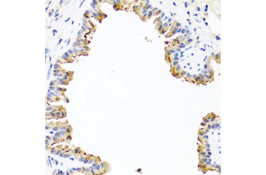 Immunohistochemistry - Anti-COL10A1 Antibody (A6889) - Antibodies.com