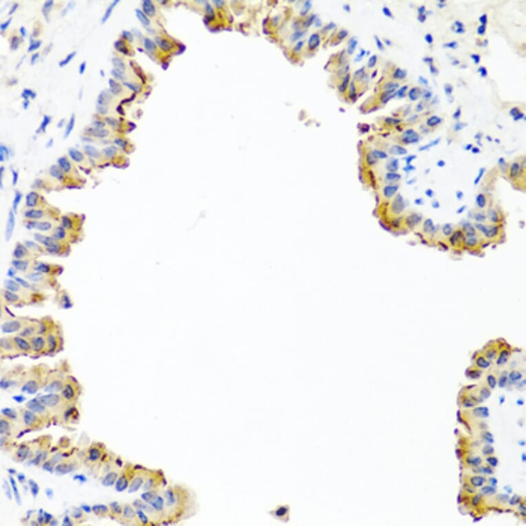 Immunohistochemistry - Anti-COL10A1 Antibody (A6889) - Antibodies.com