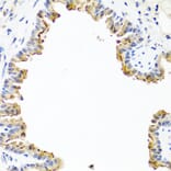 Immunohistochemistry - Anti-COL10A1 Antibody (A6889) - Antibodies.com