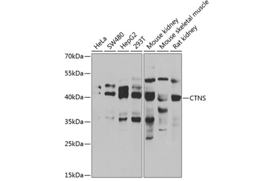 Western Blot - Anti-CTNS Antibody (A15417) - Antibodies.com