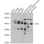 Western Blot - Anti-CTNS Antibody (A15417) - Antibodies.com