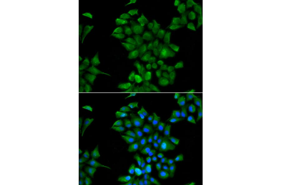 Immunofluorescence - Anti-CTNS Antibody (A15417) - Antibodies.com