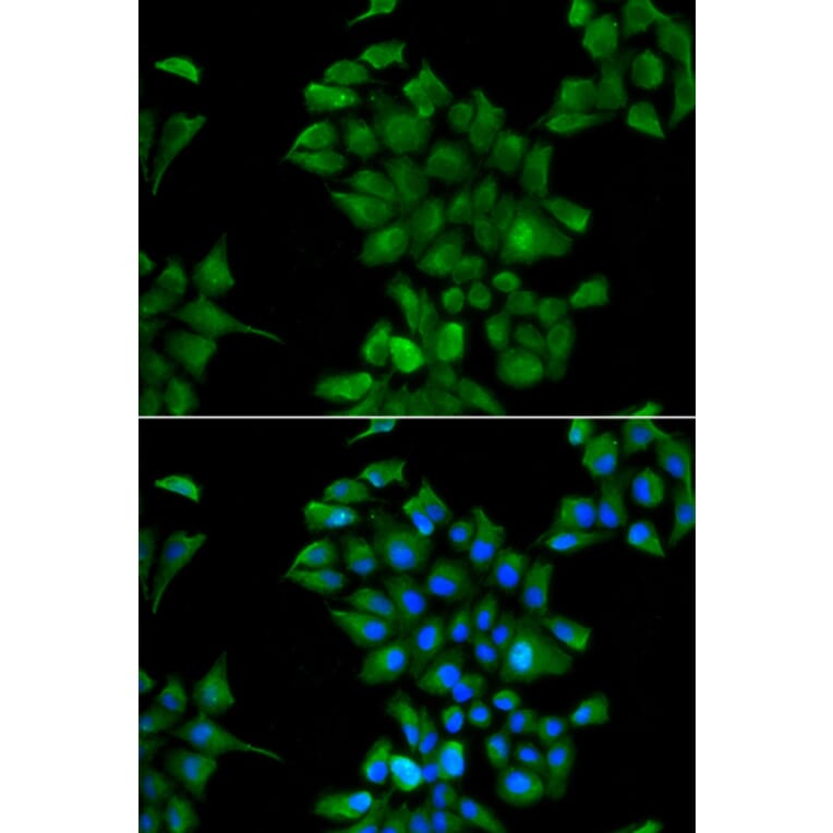 Immunofluorescence - Anti-CTNS Antibody (A15417) - Antibodies.com