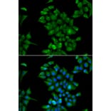 Immunofluorescence - Anti-CTNS Antibody (A15417) - Antibodies.com