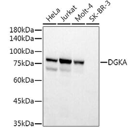 Western Blot - Anti-DGKA Antibody (A15419) - Antibodies.com