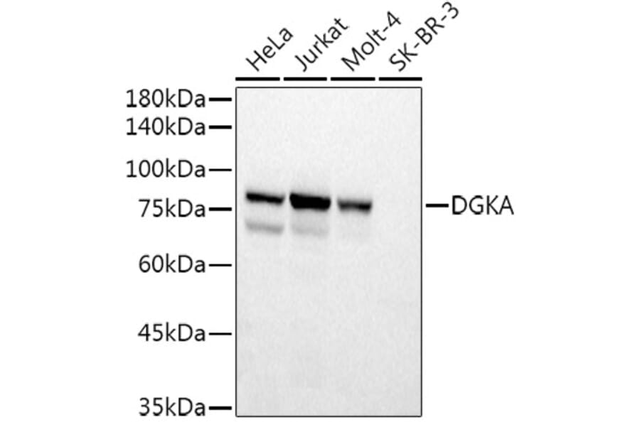 Western Blot - Anti-DGKA Antibody (A15419) - Antibodies.com