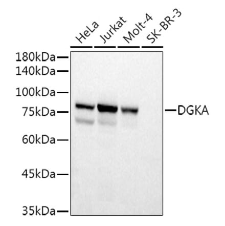 Western Blot - Anti-DGKA Antibody (A15419) - Antibodies.com