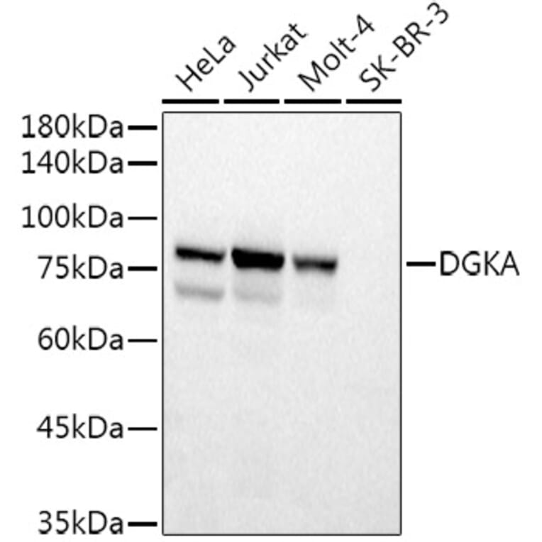 Western Blot - Anti-DGKA Antibody (A15419) - Antibodies.com