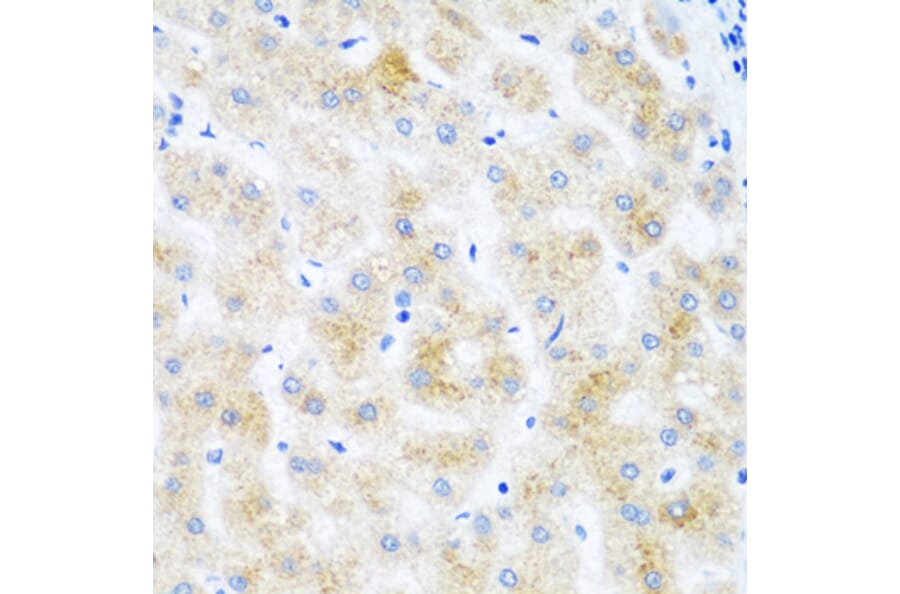 Immunohistochemistry - Anti-DHODH Antibody (A15420) - Antibodies.com