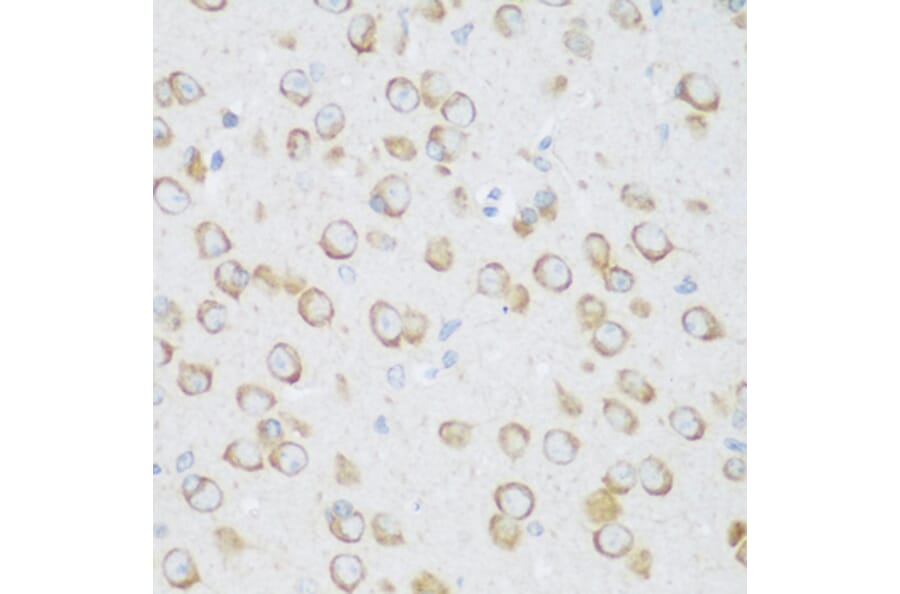 Immunohistochemistry - Anti-DHODH Antibody (A15420) - Antibodies.com