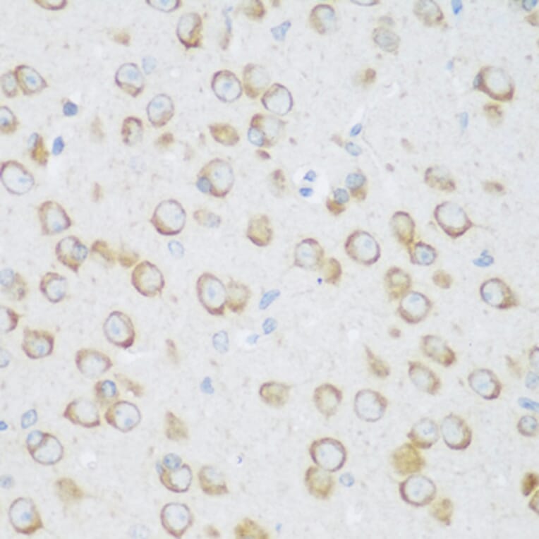 Immunohistochemistry - Anti-DHODH Antibody (A15420) - Antibodies.com