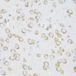 Immunohistochemistry - Anti-DHODH Antibody (A15420) - Antibodies.com