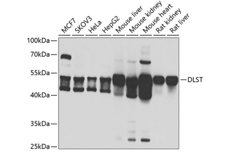 Western Blot - Anti-DLST Antibody (A15421) - Antibodies.com