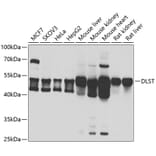 Western Blot - Anti-DLST Antibody (A15421) - Antibodies.com