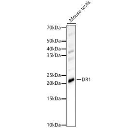 Western Blot - Anti-DR1 Antibody (A15422) - Antibodies.com