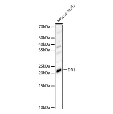 Western Blot - Anti-DR1 Antibody (A15422) - Antibodies.com