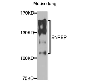 Western Blot - Anti-ENPEP Antibody (A6905) - Antibodies.com