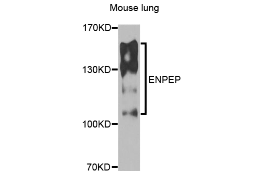 Western Blot - Anti-ENPEP Antibody (A6905) - Antibodies.com