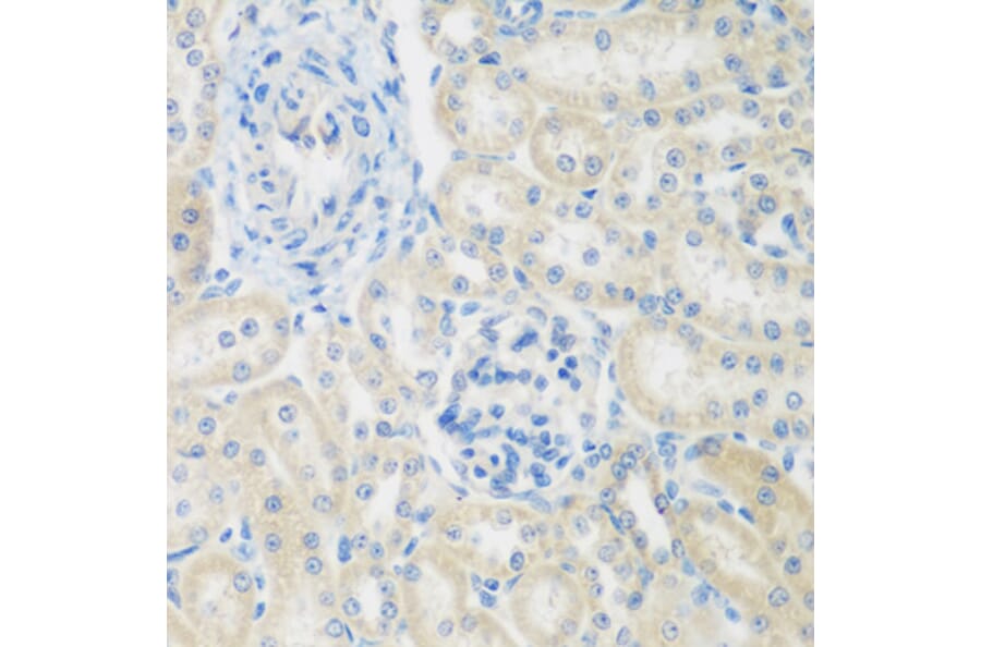 Immunohistochemistry - Anti-ENPEP Antibody (A6905) - Antibodies.com