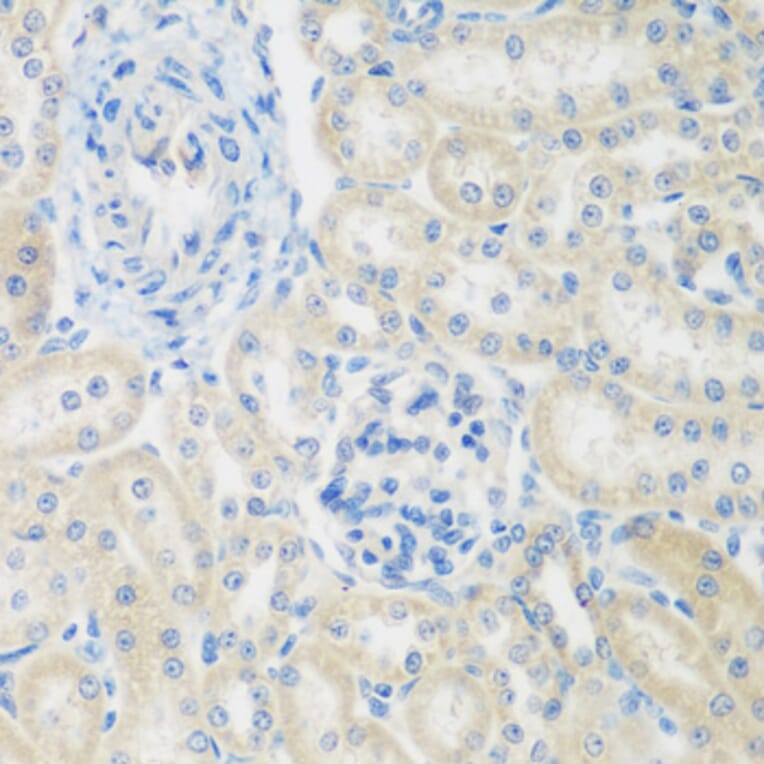 Immunohistochemistry - Anti-ENPEP Antibody (A6905) - Antibodies.com