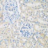 Immunohistochemistry - Anti-ENPEP Antibody (A6905) - Antibodies.com
