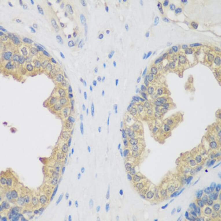 Immunohistochemistry - Anti-ENPEP Antibody (A6905) - Antibodies.com