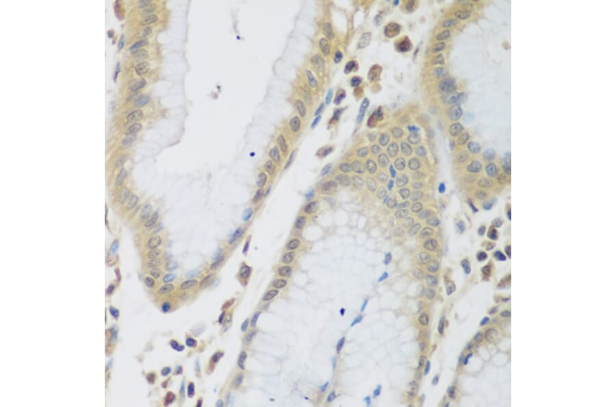 Immunohistochemistry - Anti-ENPEP Antibody (A6905) - Antibodies.com