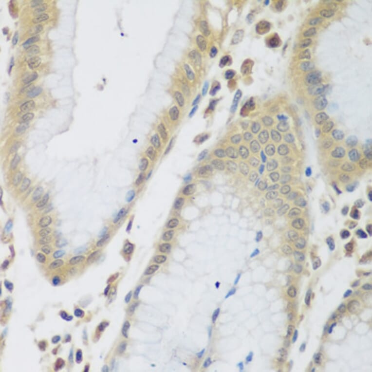 Immunohistochemistry - Anti-ENPEP Antibody (A6905) - Antibodies.com