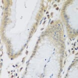 Immunohistochemistry - Anti-ENPEP Antibody (A6905) - Antibodies.com