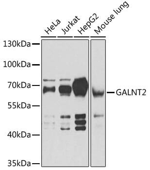 Western blot analysis of extracts of various cell lines, using Anti-GALNT2 Antibody (A6910) at 1:1,000 dilution.
Secondary antibody: Goat Anti-Rabbit IgG (H+L) (HRP) (AS014) at 1:10,000 dilution.
Lysates / proteins: 25µg per lane.
Blocking buffer: 3% non-fat dry milk in TBST.
Detection: ECL Basic Kit (RM00020).
Exposure time: 1s.