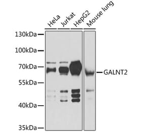 Western Blot - Anti-GALNT2 Antibody (A15424) - Antibodies.com