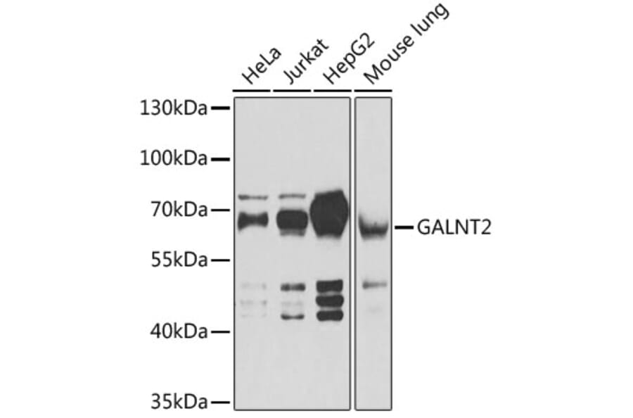 Western Blot - Anti-GALNT2 Antibody (A15424) - Antibodies.com