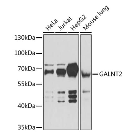 Western Blot - Anti-GALNT2 Antibody (A15424) - Antibodies.com