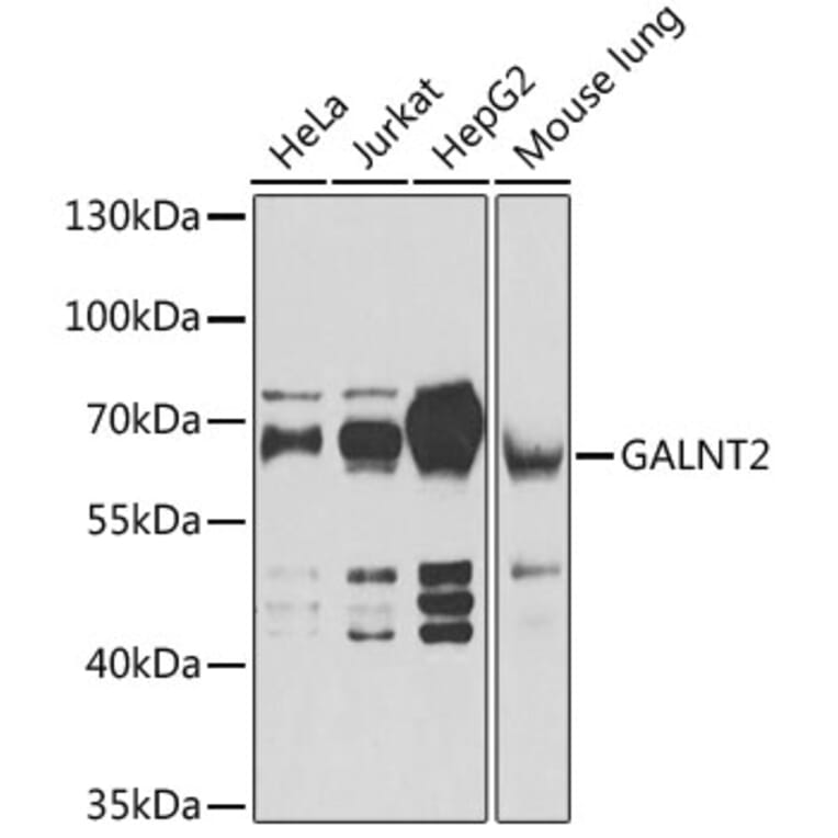 Western Blot - Anti-GALNT2 Antibody (A15424) - Antibodies.com